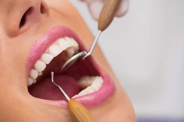 Scaling | klinikmydentist.com